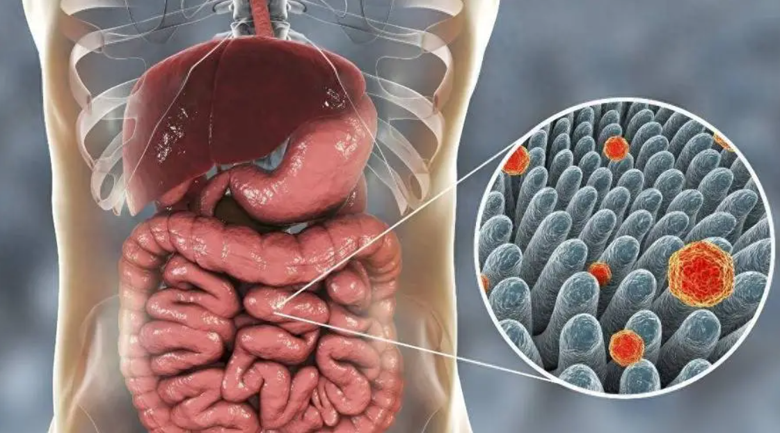 文献解读|Cell Rep Med（14.3）：独特的多细胞免疫抑制中心为左侧和
