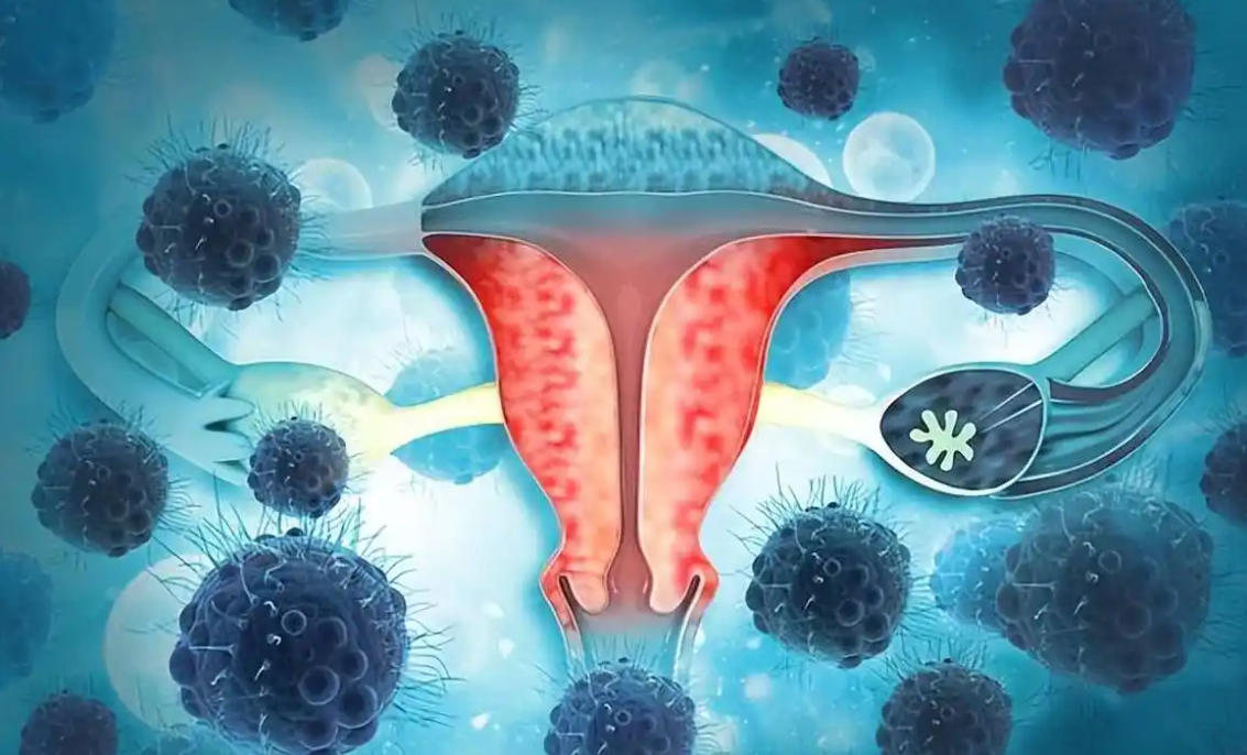 文献解读|Nat Genet（30.8）：宫颈鳞状细胞癌的多组学分析确定了具有生