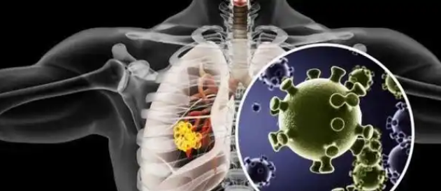 文献解读|Nat Genet（31.7）：绘制人类和小鼠肺纤维化的空间解析转录组