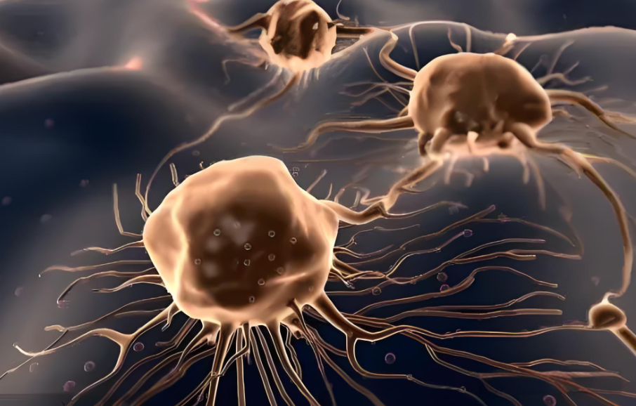 文献解读|Sci Adv（13.6）：通过空间多维蛋白质组学深入了解神经胶质瘤的