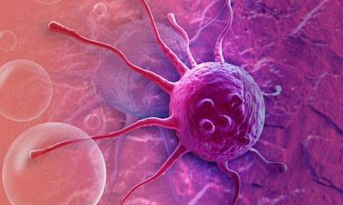 文献解读|Cell Rep Med（11.7）：脊索瘤的临床蛋白质组学分类及精准