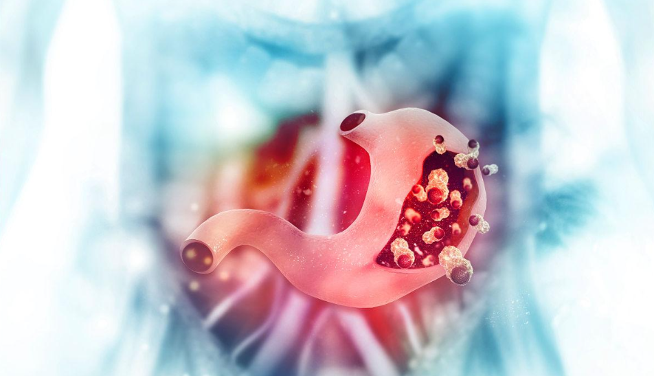 文献解读|Cell Metab（27.7）：巨噬细胞和成纤维细胞之间的烟酰胺代谢