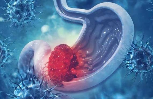 文献解读|Nat Commun（14.7）：人类胃肠道间质瘤的基因组和转录组图