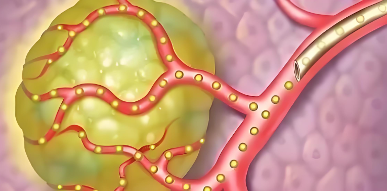 文献解读|Nat Commun（14.7）：全外显子组测序揭示肝内胆管癌的基因组