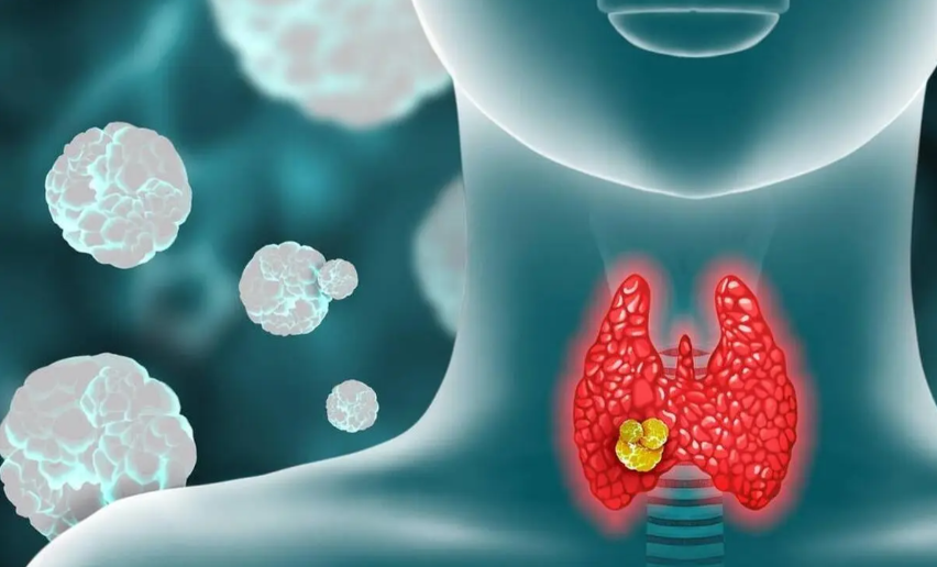 文献解读|Nat Commun（14.7）：综合蛋白质组学表征揭示低分化和未分化