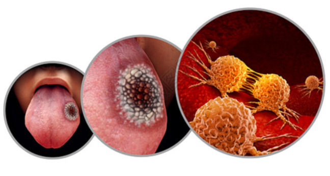 文献解读|Genome Biol（10.4）：多组学揭示了乳酸化驱动的调节机制促