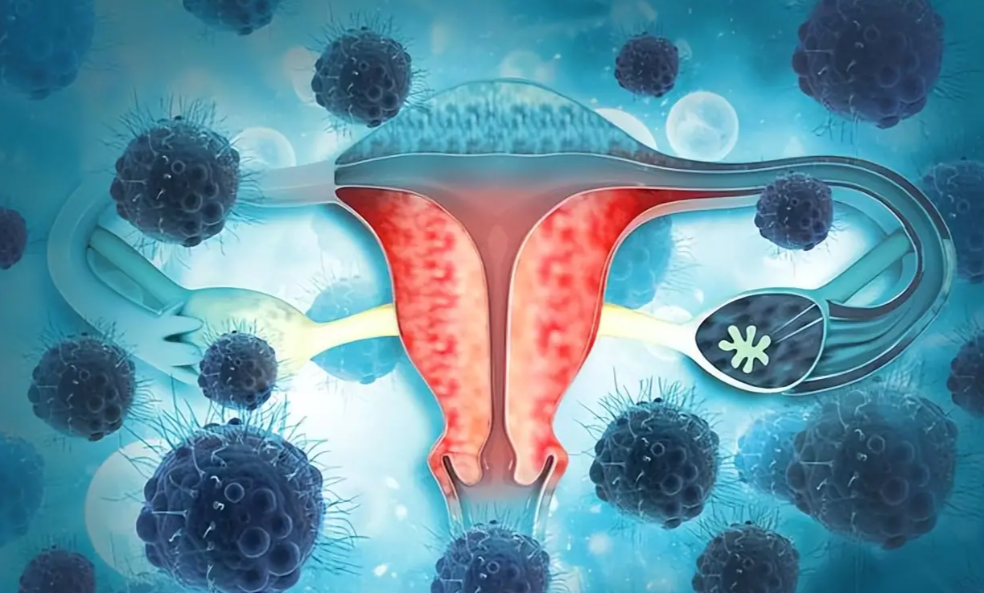 文献解读|Nat Commun（14.7）：宫颈癌的蛋白质组学分析揭示了治疗和生